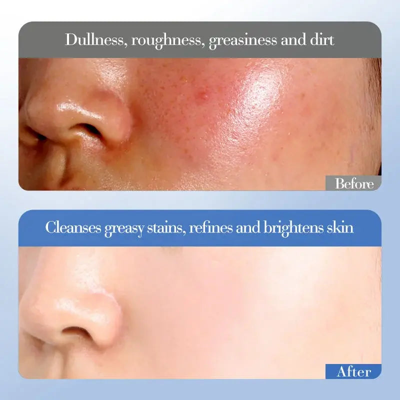 Crema Facial Hidratante Profunda – Iluminadora con Niacinamida y Arroz (50g)
